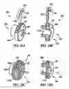 Fig. 19 - System and method for replacement of spinal motion segment
