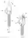 Fig. 02 - Dynamic bone fastener with a preset range of motion