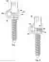 Fig. 07 - Dynamic bone fastener with a preset range of motion