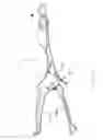 Fig. 02 - Rod reducing instrument and methods of use thereof