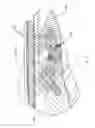 Fig. 03 - Rod reducing instrument and methods of use thereof
