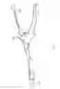 Fig. 04 - Rod reducing instrument and methods of use thereof