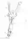 Fig. 07 - Rod reducing instrument and methods of use thereof