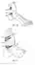 Fig. 06 - Implantable device for relieving ankle pain