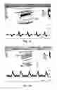 Fig. 03 - Treatment
