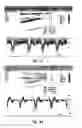 Fig. 06 - Treatment