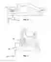 Fig. 03 - IMPLANT RECHARGING