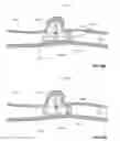 Fig. 48 - Lumen-traveling biological interface device and method of use