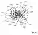 Fig. 75 - Lumen-traveling biological interface device and method of use