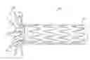 Fig. 01 - Fenestrated intraluminal stent system