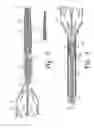 Fig. 03 - Fenestrated intraluminal stent system