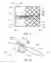Fig. 13 - Proximal release delivery system