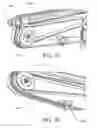 Fig. 17 - Proximal release delivery system