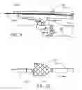 Fig. 20 - Proximal release delivery system