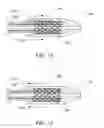 Fig. 26 - Proximal release delivery system