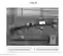 Fig. 08 - Correction and optimization of wave reflection in blood vessels