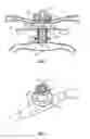 Fig. 02 - METHOD AND SYSTEM OF DEVICES FOR PERMANENT ACCESS TO THE CIRCULATORY SYSTEM FOR CHRONIC HEMODIALYSIS