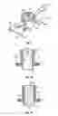 Fig. 04 - METHOD AND SYSTEM OF DEVICES FOR PERMANENT ACCESS TO THE CIRCULATORY SYSTEM FOR CHRONIC HEMODIALYSIS