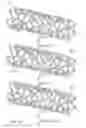 Fig. 11 - BIOERODIBLE ENDOPROSTHESES AND METHODS OF MAKING THE SAME