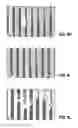 Fig. 09 - Implant with a surface layer having a topographic modification