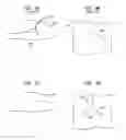 Fig. 09 - Repositioning of prosthetic heart valve and deployment