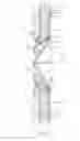 Fig. 05 - Prosthesis for reducing intra-cardiac pressure having an embolic filter
