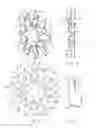 Fig. 06 - Prosthesis for reducing intra-cardiac pressure having an embolic filter