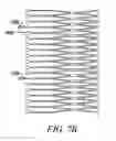 Fig. 08 - Prosthesis for reducing intra-cardiac pressure having an embolic filter