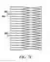 Fig. 09 - Prosthesis for reducing intra-cardiac pressure having an embolic filter