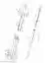 Fig. 12 - Prosthesis for reducing intra-cardiac pressure having an embolic filter