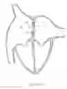 Fig. 28 - Prosthesis for reducing intra-cardiac pressure having an embolic filter