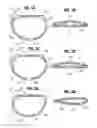 Fig. 02 - Flexible annuloplasty ring with select control points