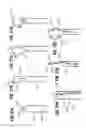 Fig. 10 - Flexible annuloplasty ring with select control points