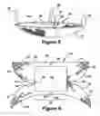 Fig. 06 - IMPLANTABLE PROSTHESIS FOR POSITIONING AND SUPPORTING A BREAST IMPLANT