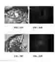Fig. 20 - Compositions and methods for treating bone defects
