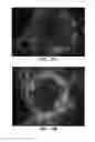 Fig. 25 - Compositions and methods for treating bone defects