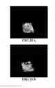Fig. 34 - Compositions and methods for treating bone defects