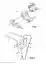 Fig. 02 - Retaining member for a joint prosthesis