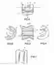 Fig. 03 - Retaining member for a joint prosthesis