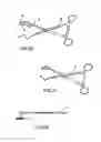 Fig. 10 - Retaining member for a joint prosthesis