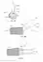 Fig. 09 - Elbow prosthesis and method for use