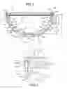 Fig. 03 - Acetabular cup having deformation resistant features