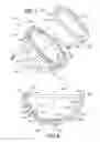 Fig. 05 - Acetabular cup having deformation resistant features