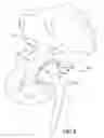 Fig. 06 - Acetabular cup having deformation resistant features