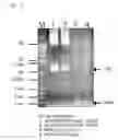 Fig. 05 - Method for Preparation and Purification of Recombinant Proteins