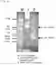 Fig. 06 - Method for Preparation and Purification of Recombinant Proteins
