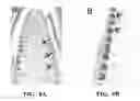 Fig. 14 - Nucleotide sequences encoding RAMOSA3 and Sister of RAMOSA3 and methods of use for same