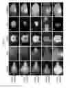 Fig. 11 - Soybean transcription terminators and use in expression of transgenic genes in plants