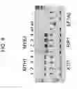 Fig. 17 - Soybean transcription terminators and use in expression of transgenic genes in plants