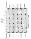 Fig. 19 - Soybean transcription terminators and use in expression of transgenic genes in plants